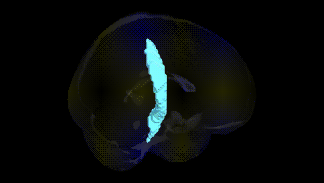 Full Brain Black