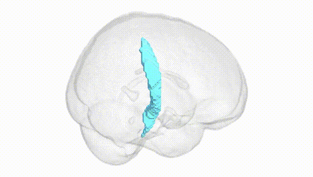 Full Brain White