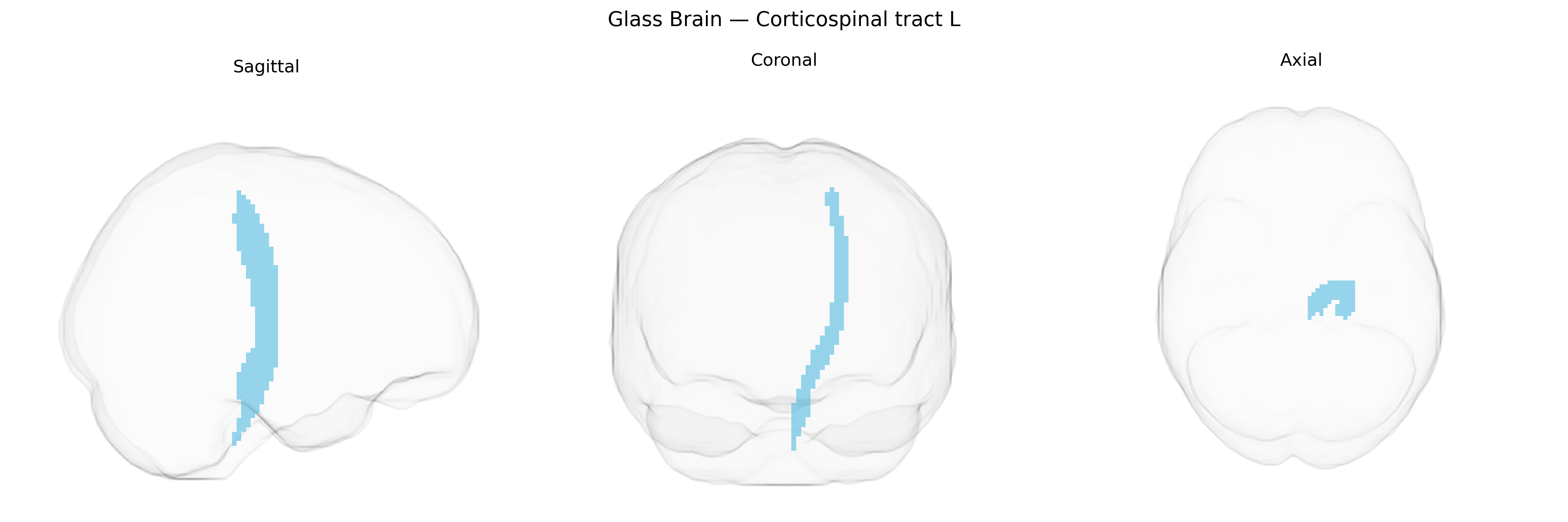 Triplanar Ghost Brain