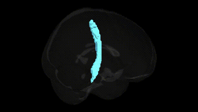 Full Brain Black