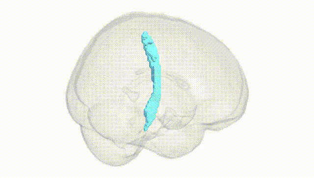 Full Brain White