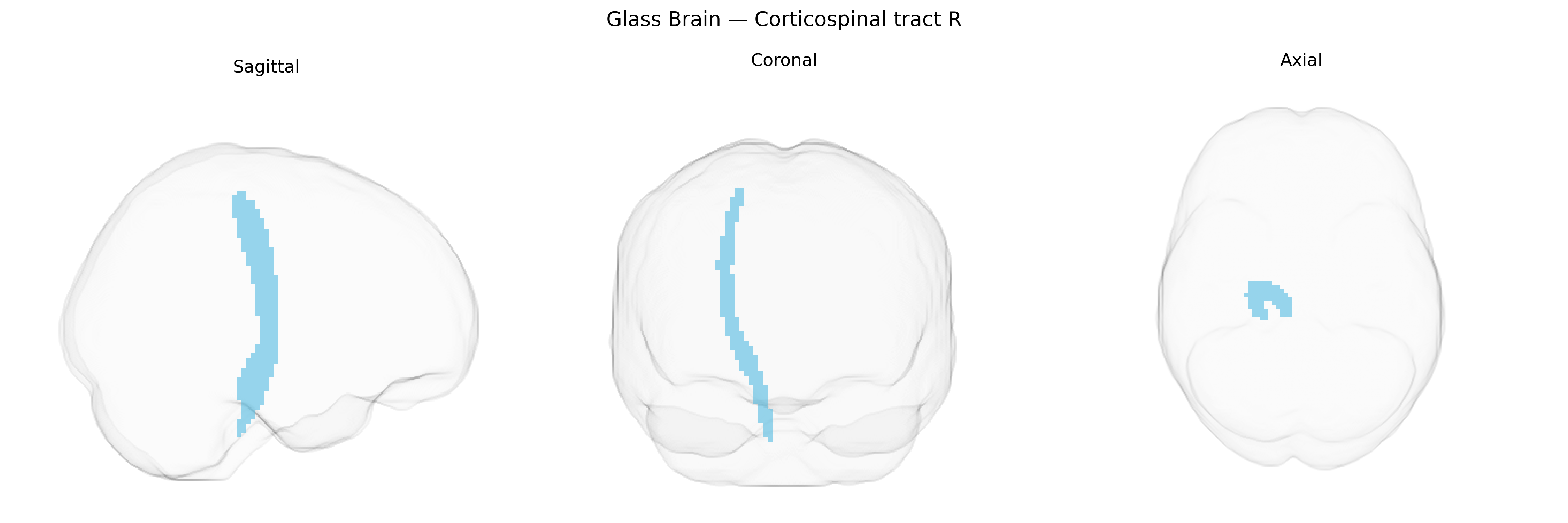 Triplanar Ghost Brain