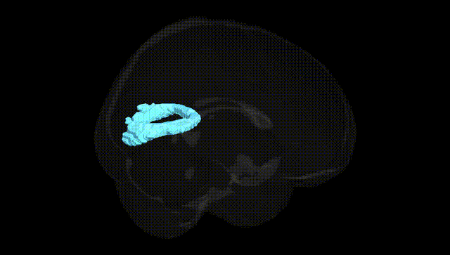 Full Brain Black