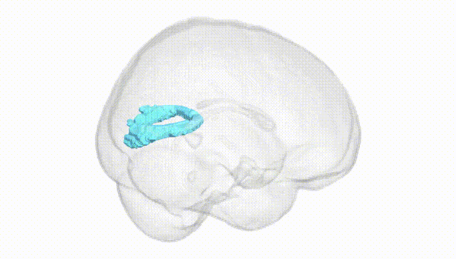 Full Brain White
