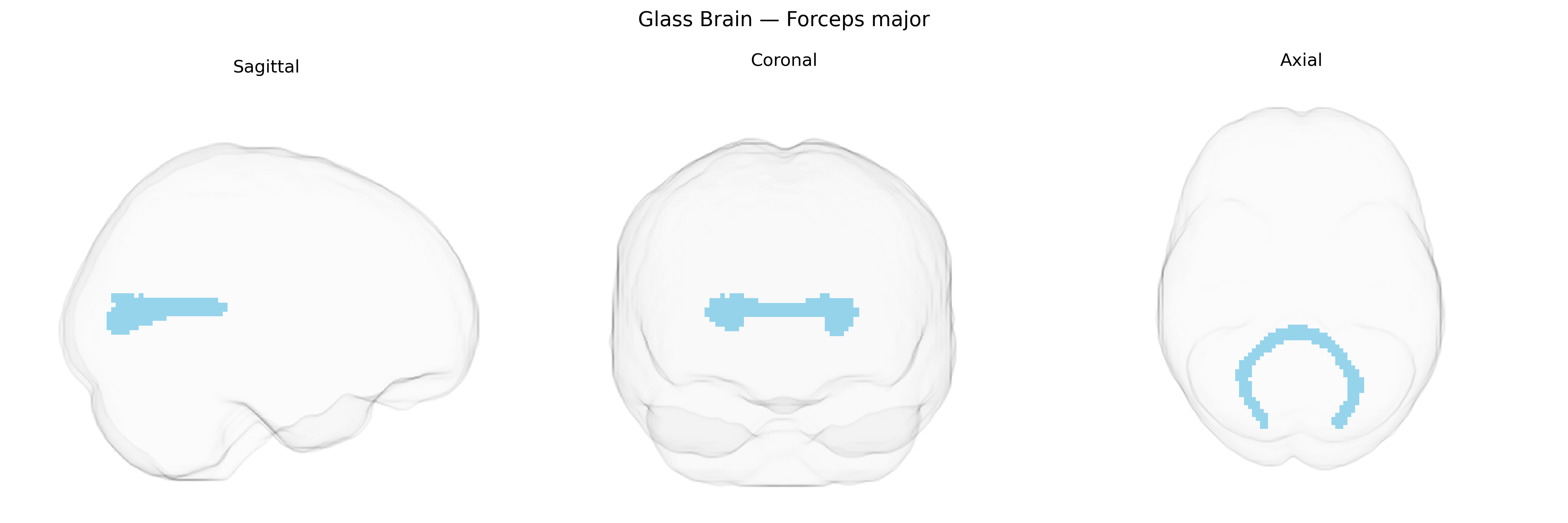 Triplanar Ghost Brain