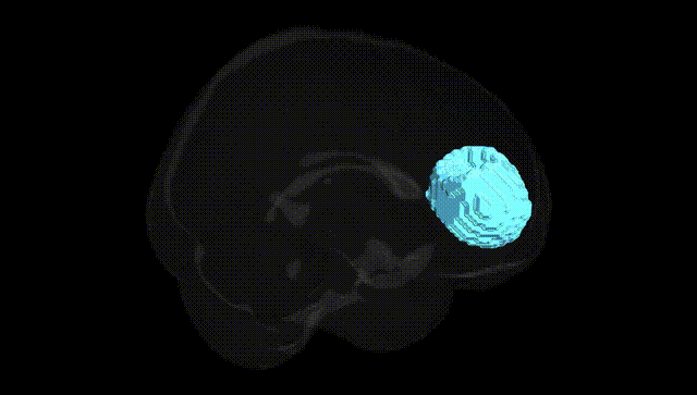Full Brain Black