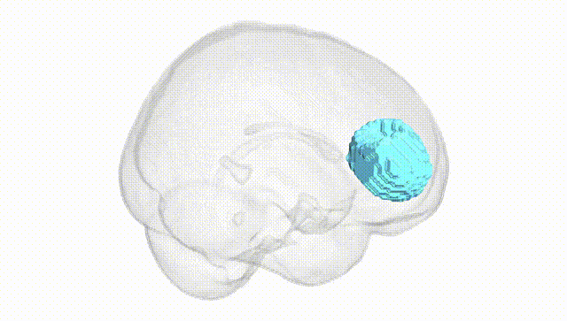 Full Brain White