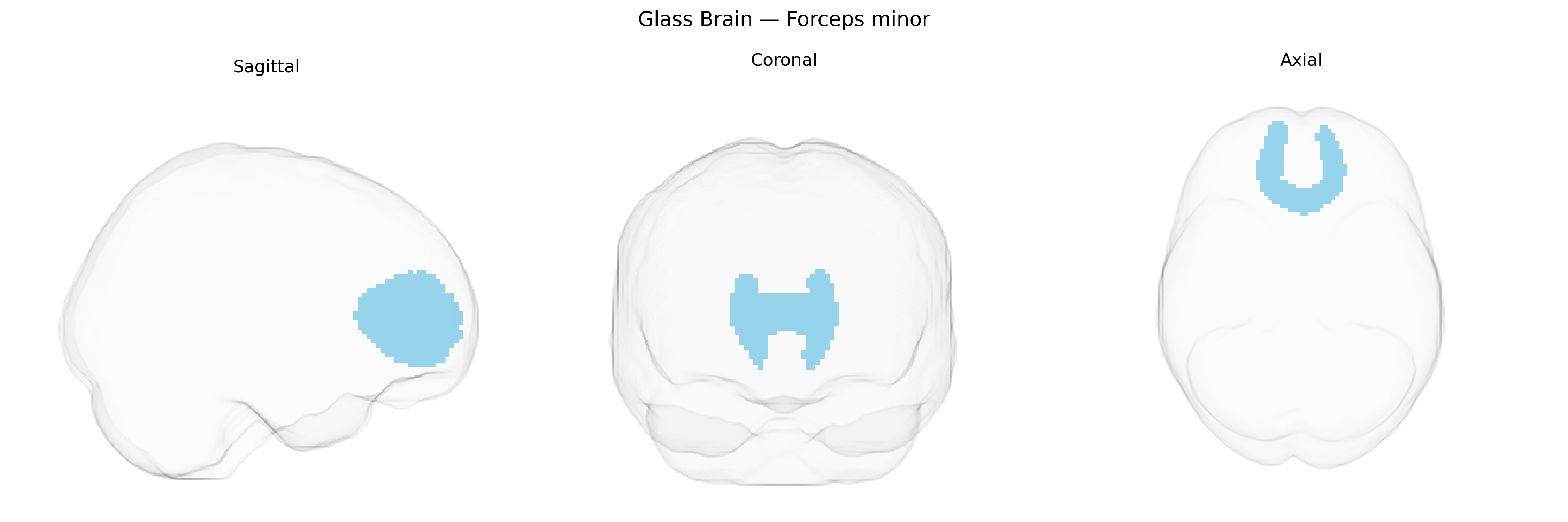Triplanar Ghost Brain