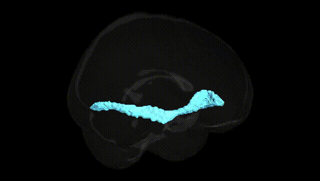 Full Brain Black