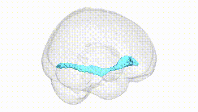 Full Brain White