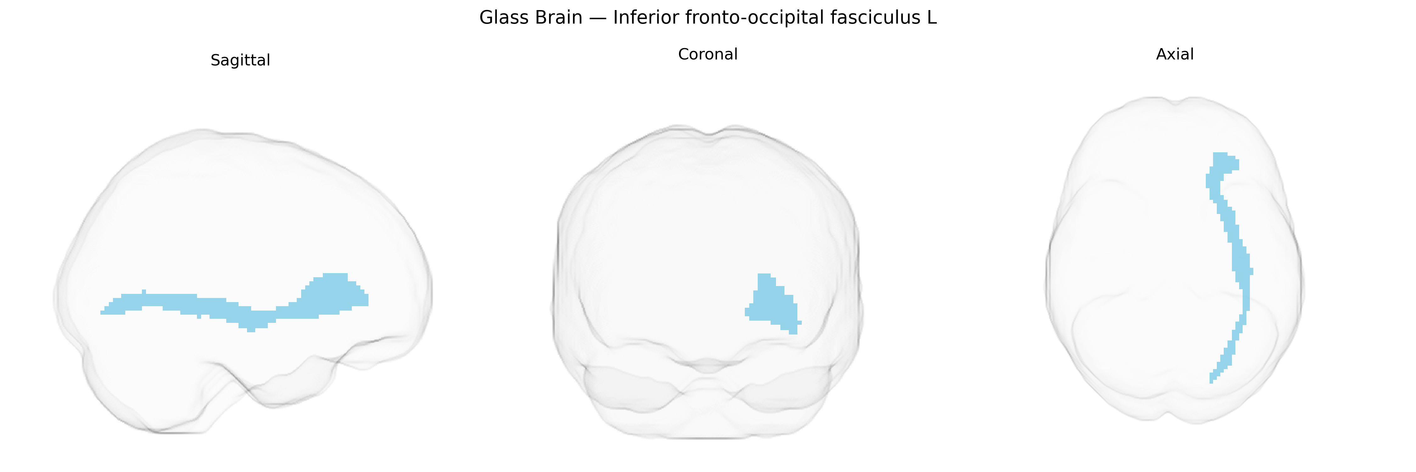 Triplanar Ghost Brain