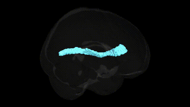 Full Brain Black