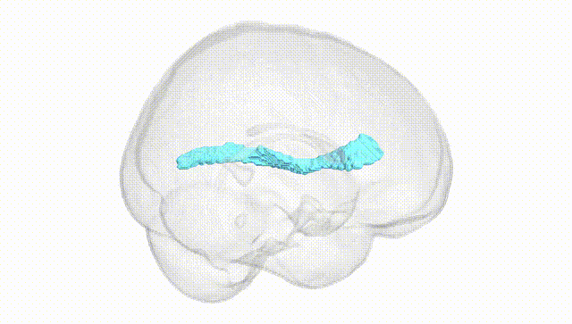 Full Brain White