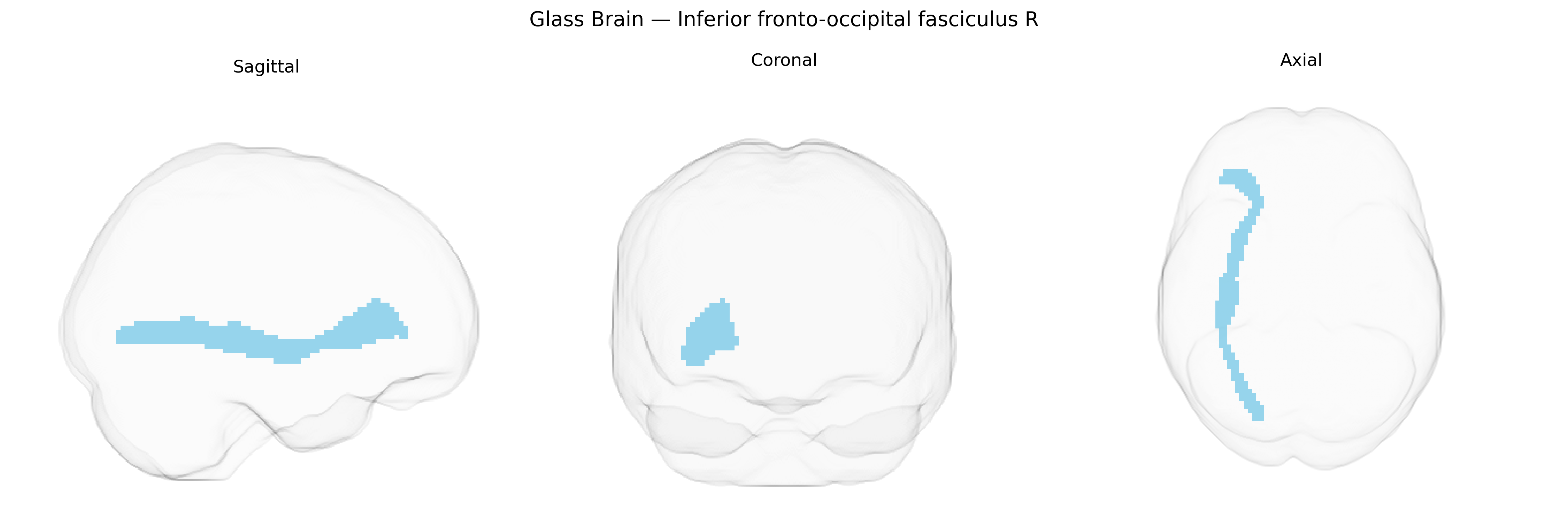 Triplanar Ghost Brain