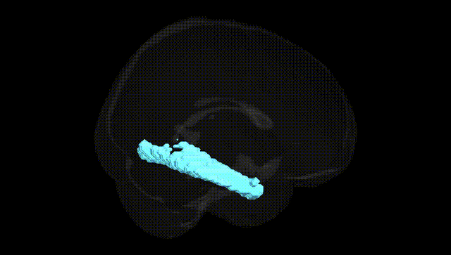 Full Brain Black