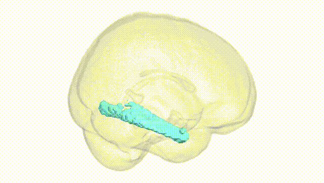 Full Brain White