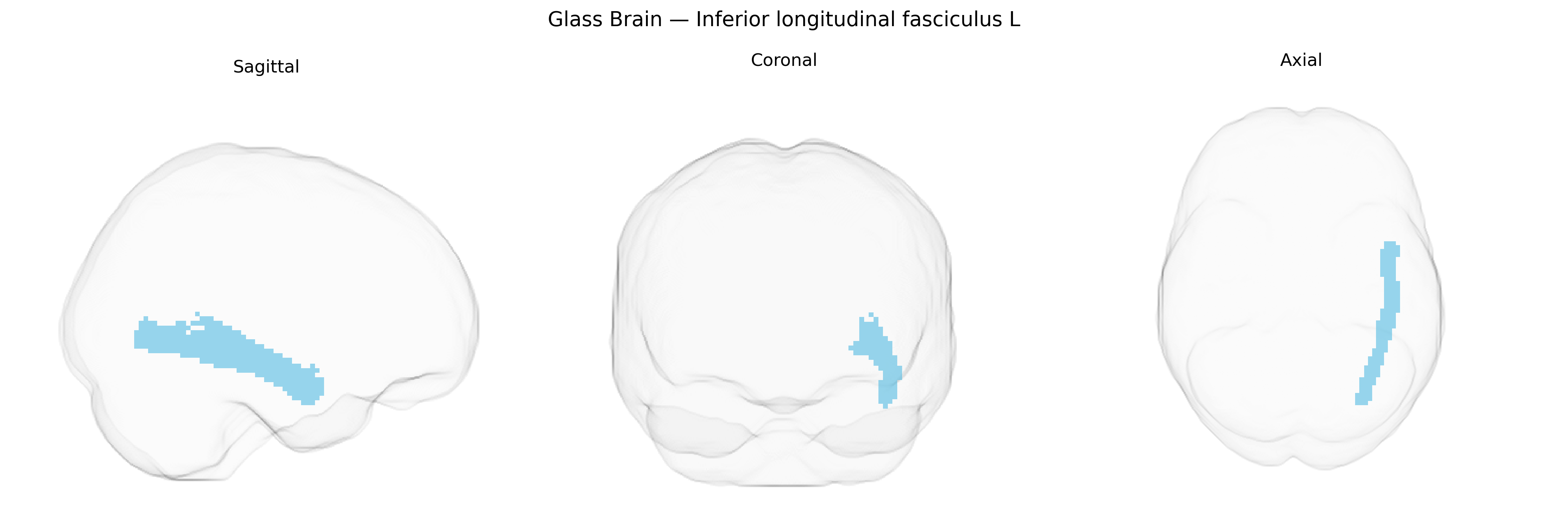Triplanar Ghost Brain