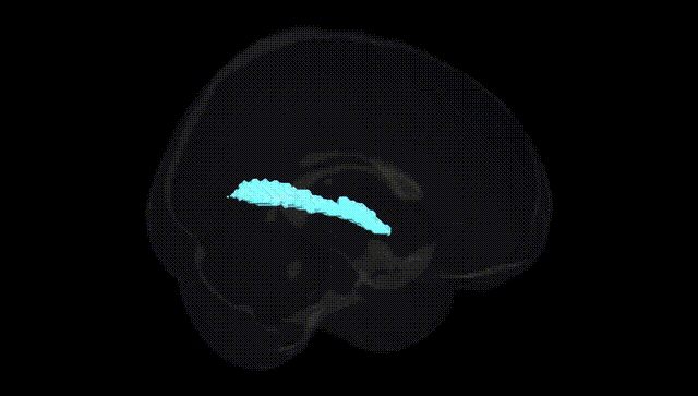 Full Brain Black