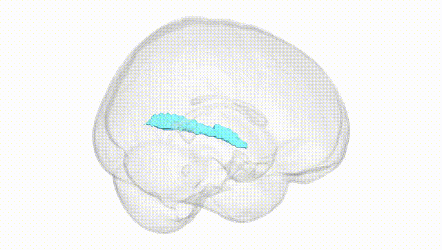 Full Brain White