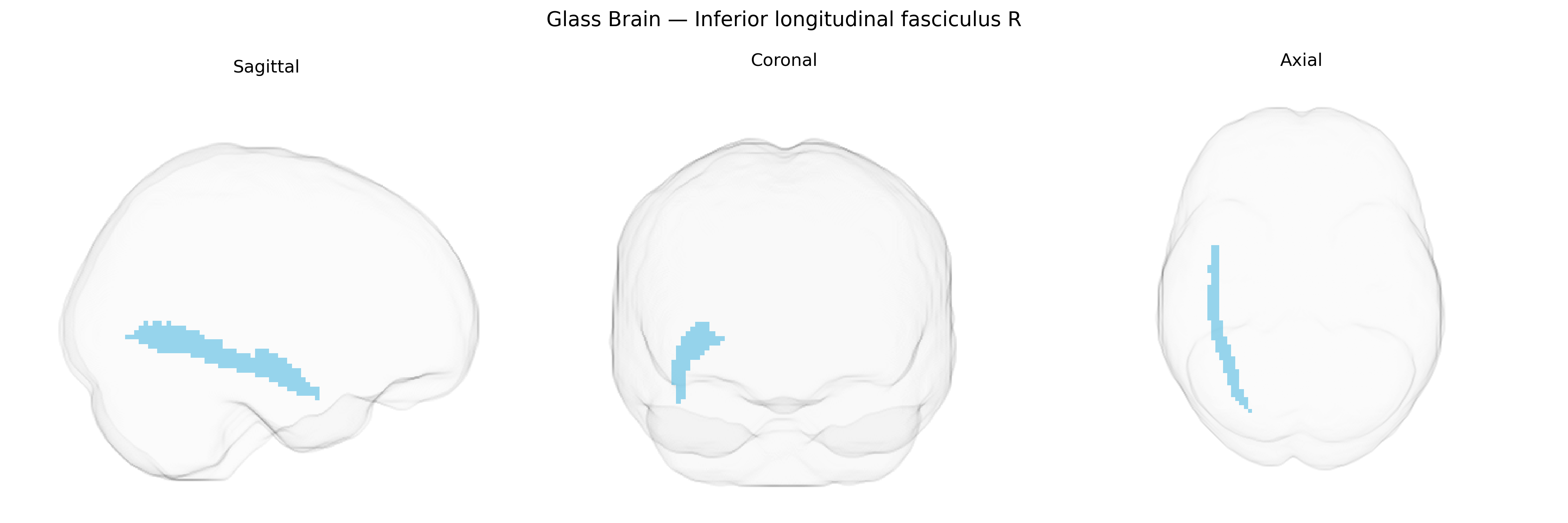 Triplanar Ghost Brain