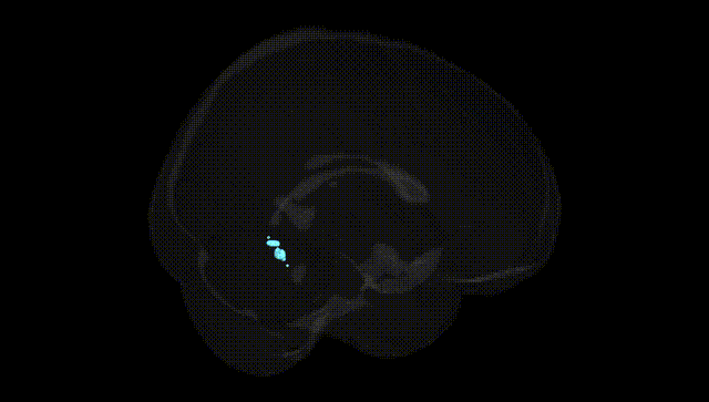 Full Brain Black