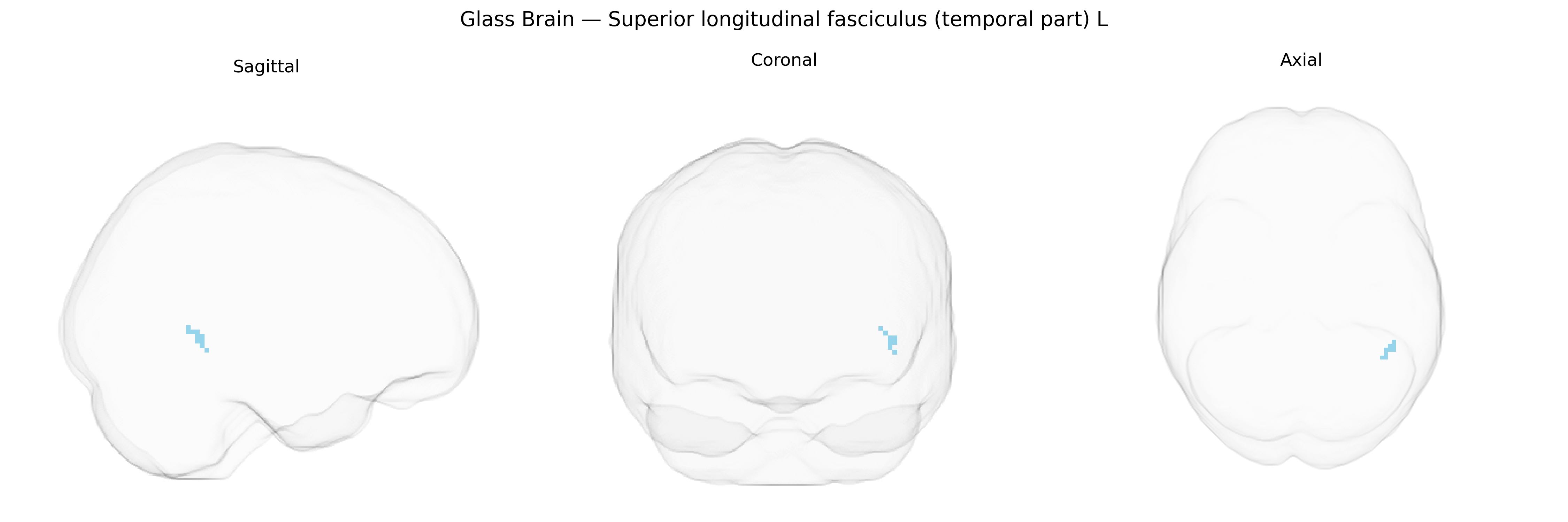 Triplanar Ghost Brain