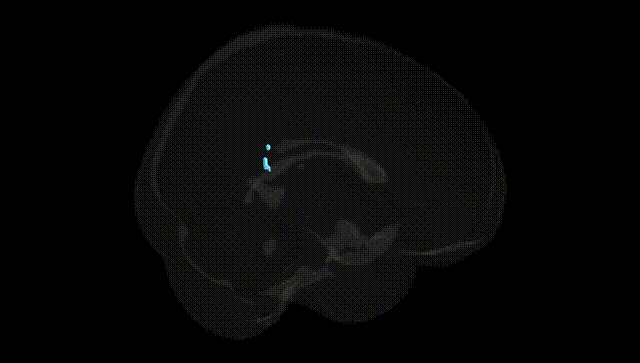 Full Brain Black