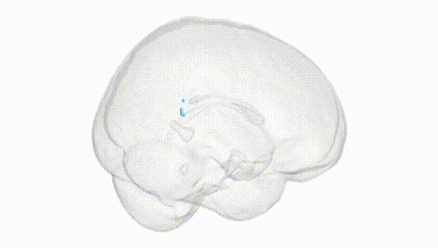 Full Brain White