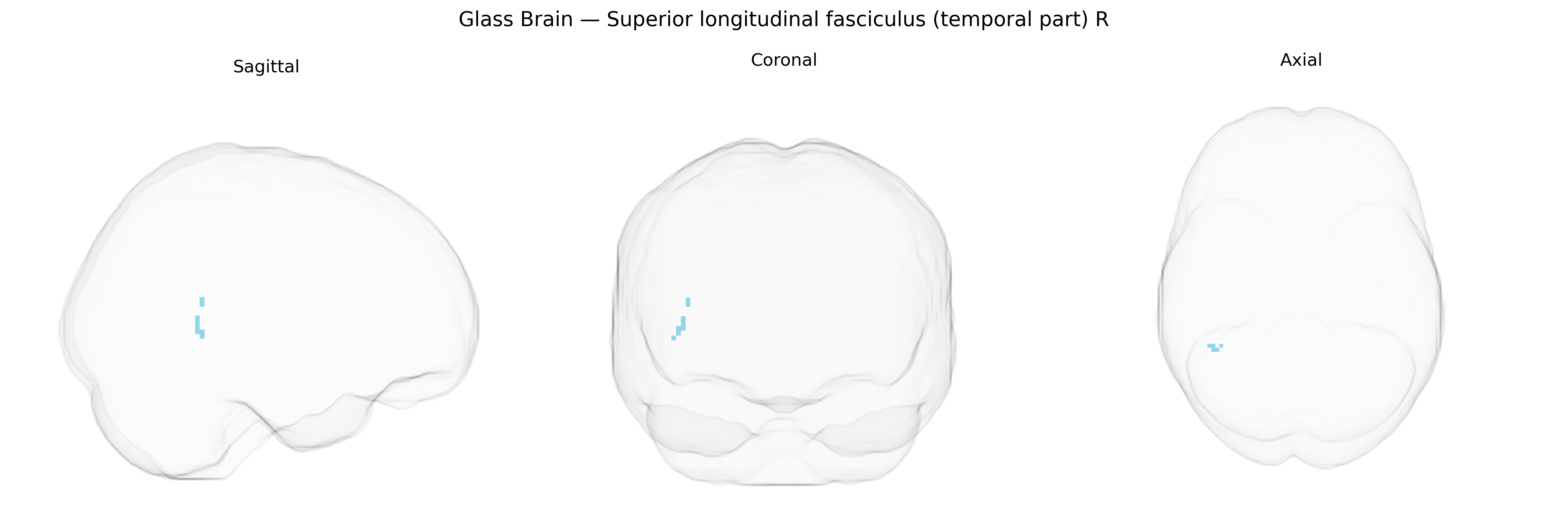 Triplanar Ghost Brain