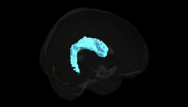Full Brain Black