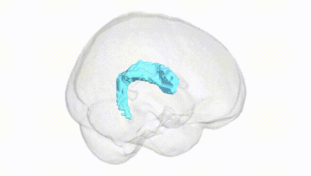 Full Brain White