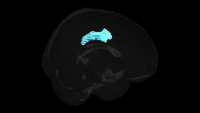 Full Brain Black