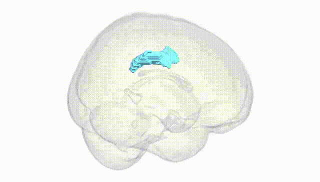 Full Brain White