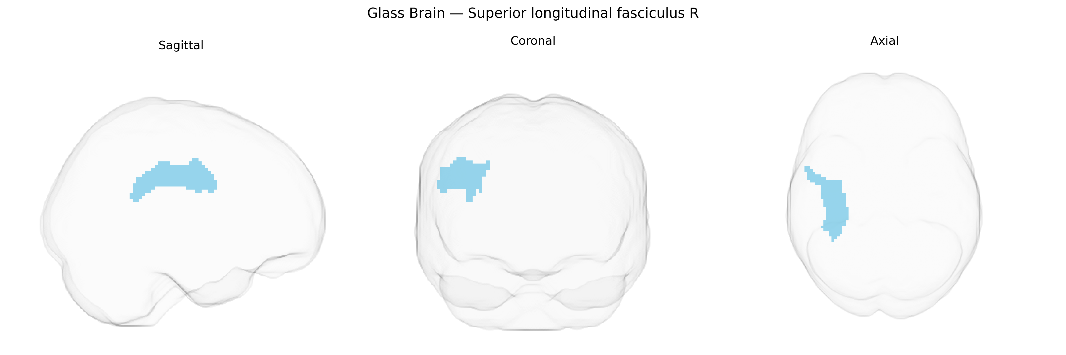 Triplanar Ghost Brain