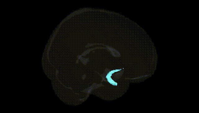 Full Brain Black