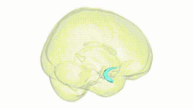 Full Brain White