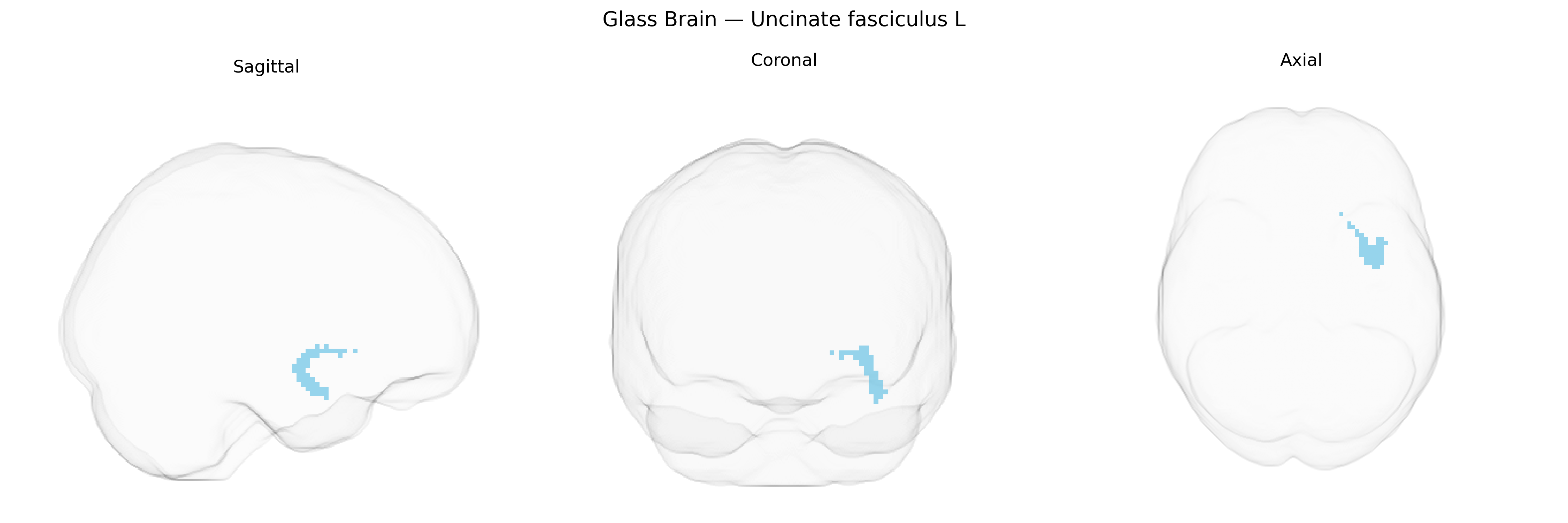 Triplanar Ghost Brain