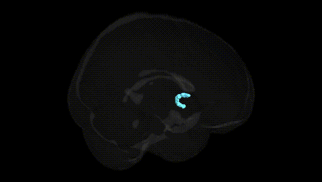 Full Brain Black