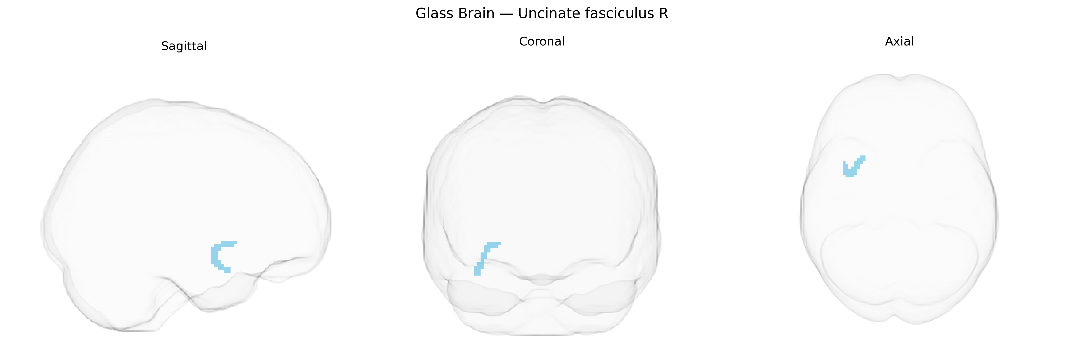 Triplanar Ghost Brain