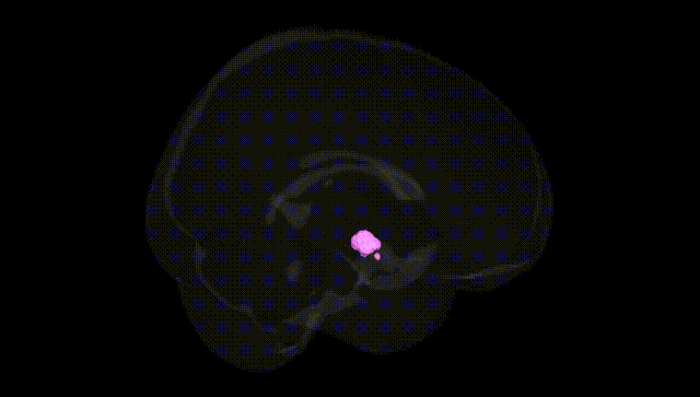 Full Brain Black