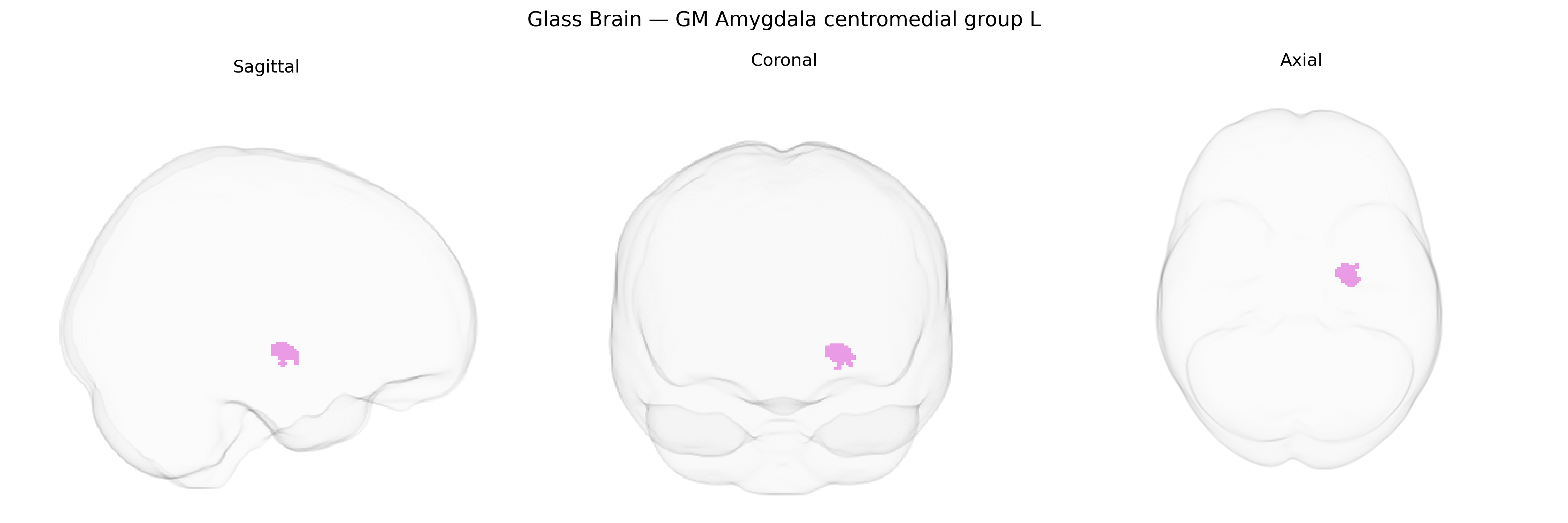 Triplanar Ghost Brain