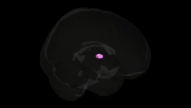 Full Brain Black