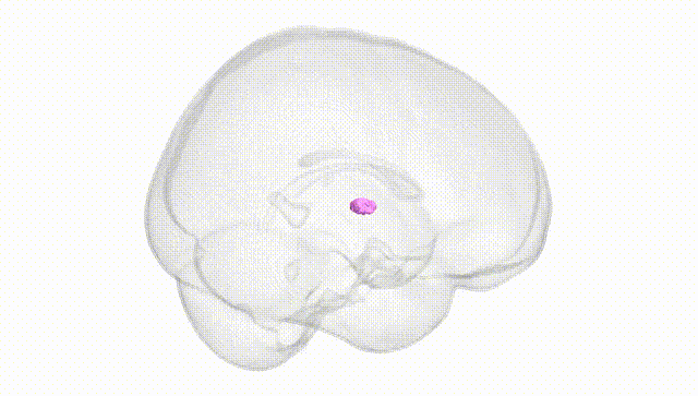 Full Brain White