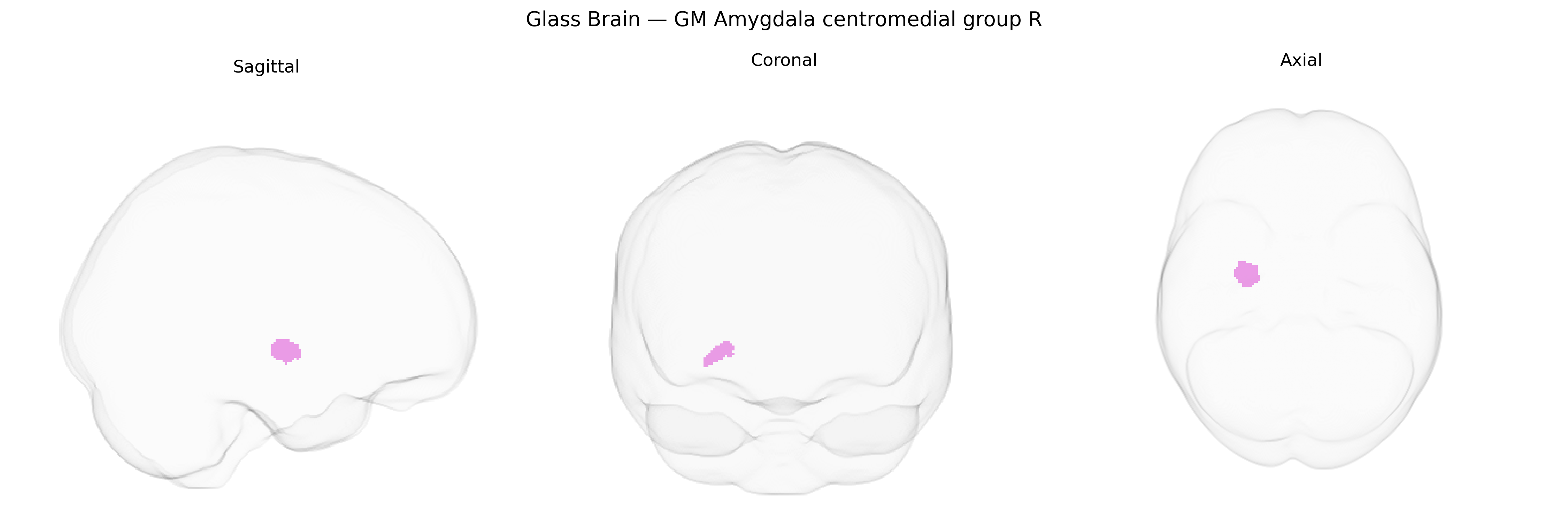 Triplanar Ghost Brain