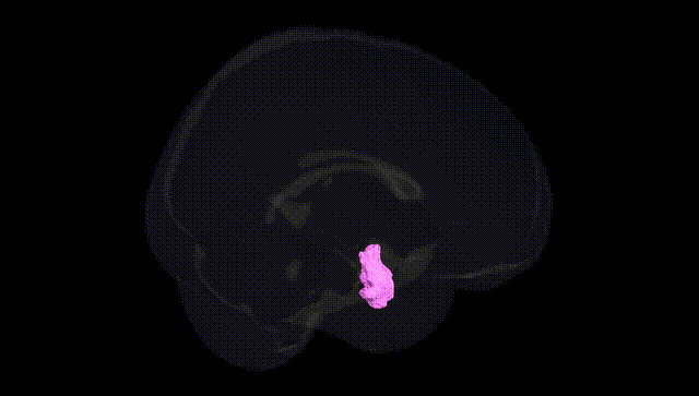 Full Brain Black