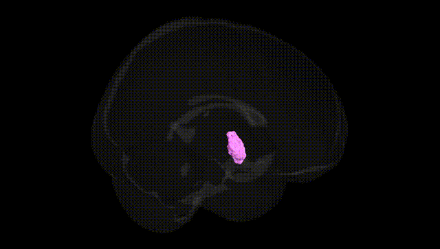 Full Brain Black