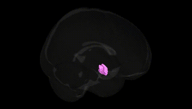 Full Brain Black