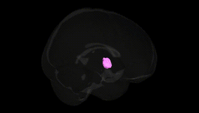 Full Brain Black