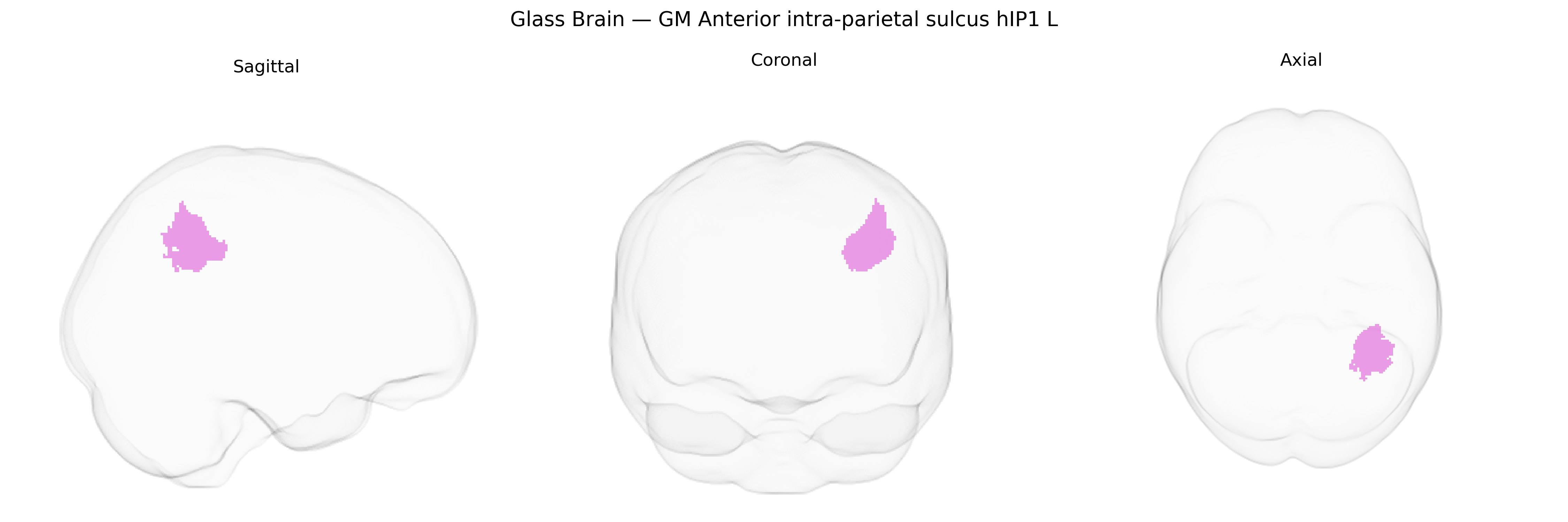 Triplanar Ghost Brain