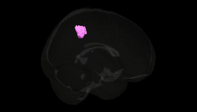 Full Brain Black